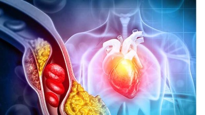 medical illustration of heart, lungs and arteries